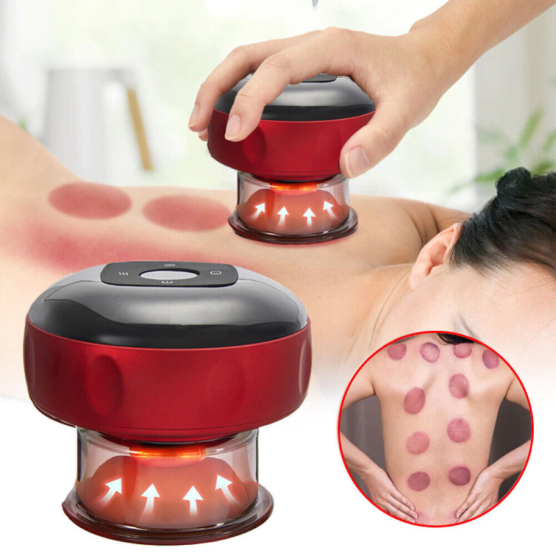 Electric Cupping Massage Device